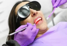 How Laser Dentistry is Revolutionizing Dental Procedures