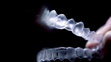 Oops Aligners: A Comprehensive Guide to Straightening Your Smile