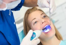 Five Simple Tips for Finding Your Ideal Dentist