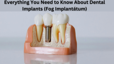 Fog Implantátum